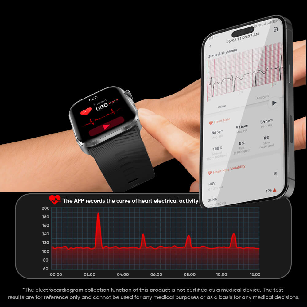 AEGVITA D6 ECG AI cardiac analysis