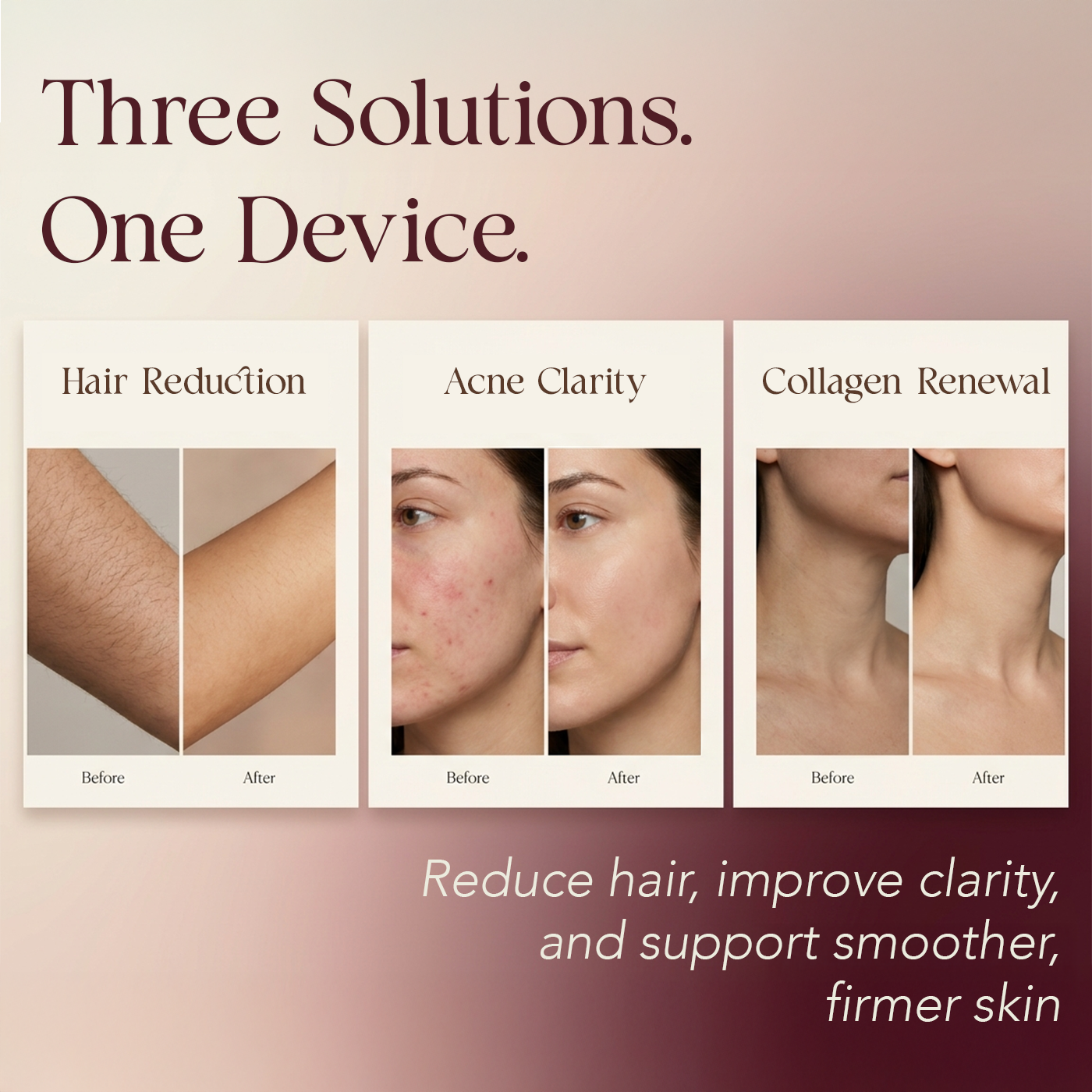 Elara IPL Laser Hair Removal Device - feature highlight built-in cooling system for painless use