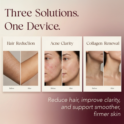 Elara IPL Laser Hair Removal Device - feature highlight built-in cooling system for painless use