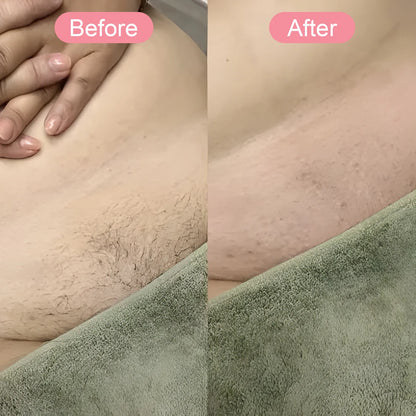 Geekik Bikini Trimmer Result 5