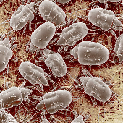 Scanning electron micrograph of dust mites on fabric