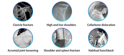Zenvora Posture Corrector for Women and Men feature view 3