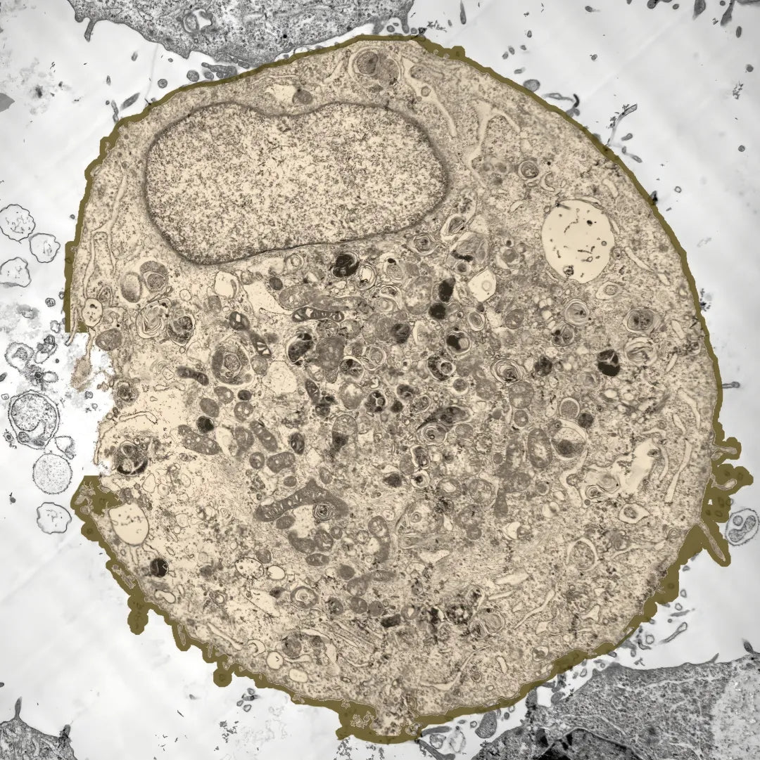 Electron microscope image of a cell structure