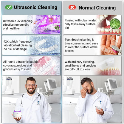 Denturexi Ultrasonic Retainer Cleaner showcase image