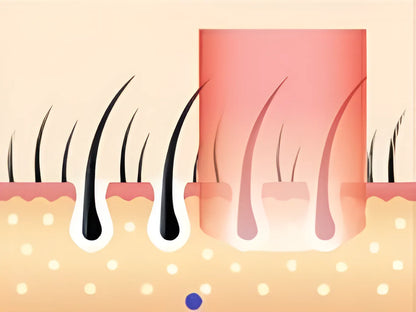Lunaxon IPL Hair Removal AS20 treatment schedule for weeks 1 to 2